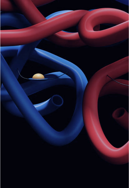 Microneedle Patches for Vaccines