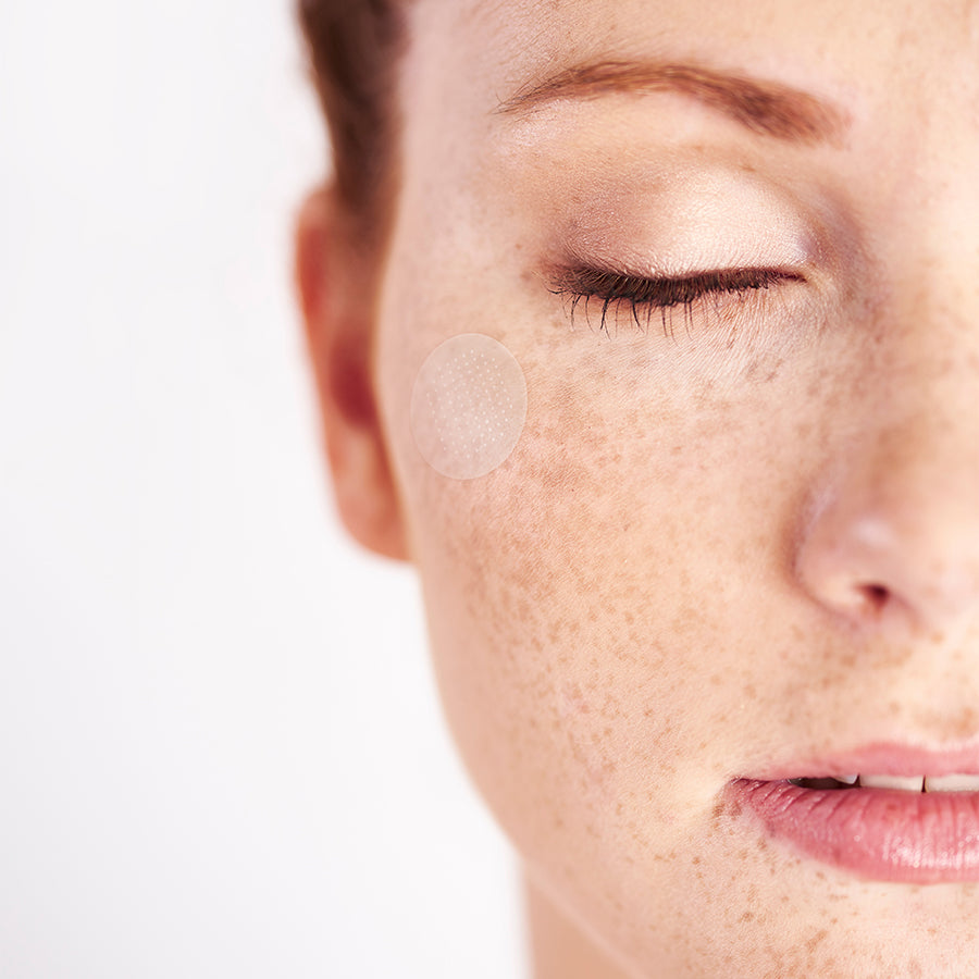 Whitening & Spot-Lightening Microneedle Patches | Dissolving Microneedle Beauty