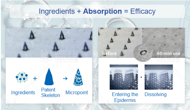 Why Dissolving Microneedle Technology is Good For Cosmetic Products