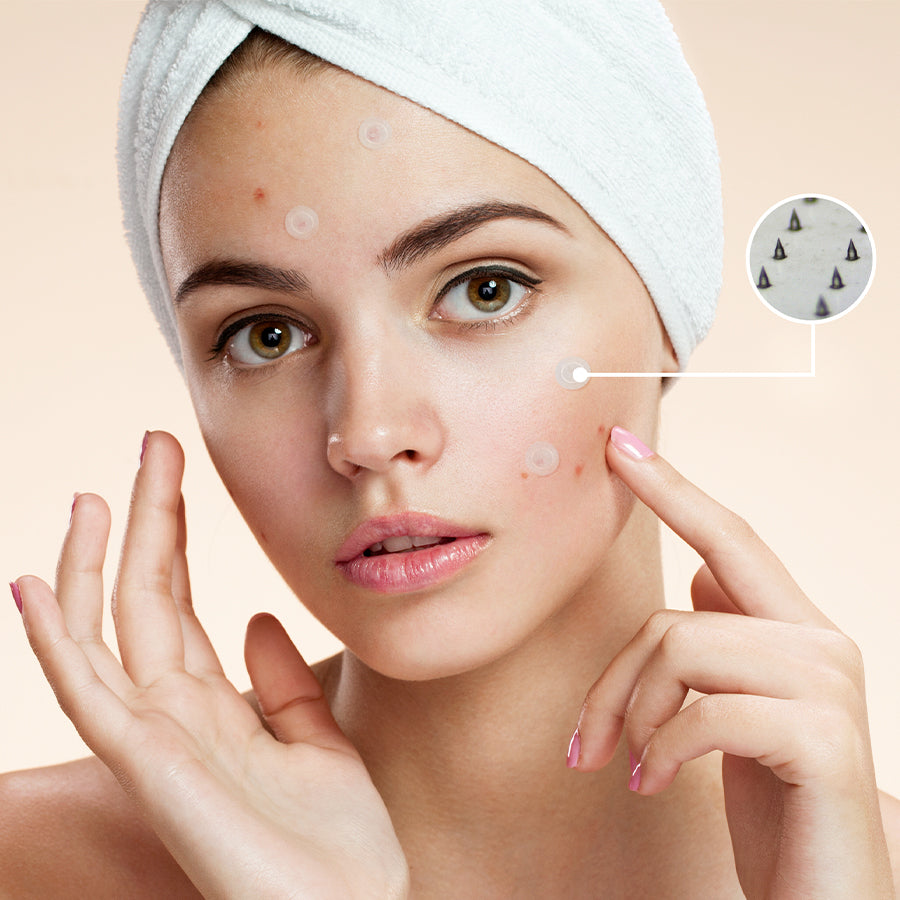 Acne Pimple Microneedle Array Patches